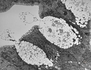 normal mucosa - duodenum - enterocytes and goblet cells normal mucosa - duodenum - enterocytes and goblet cells